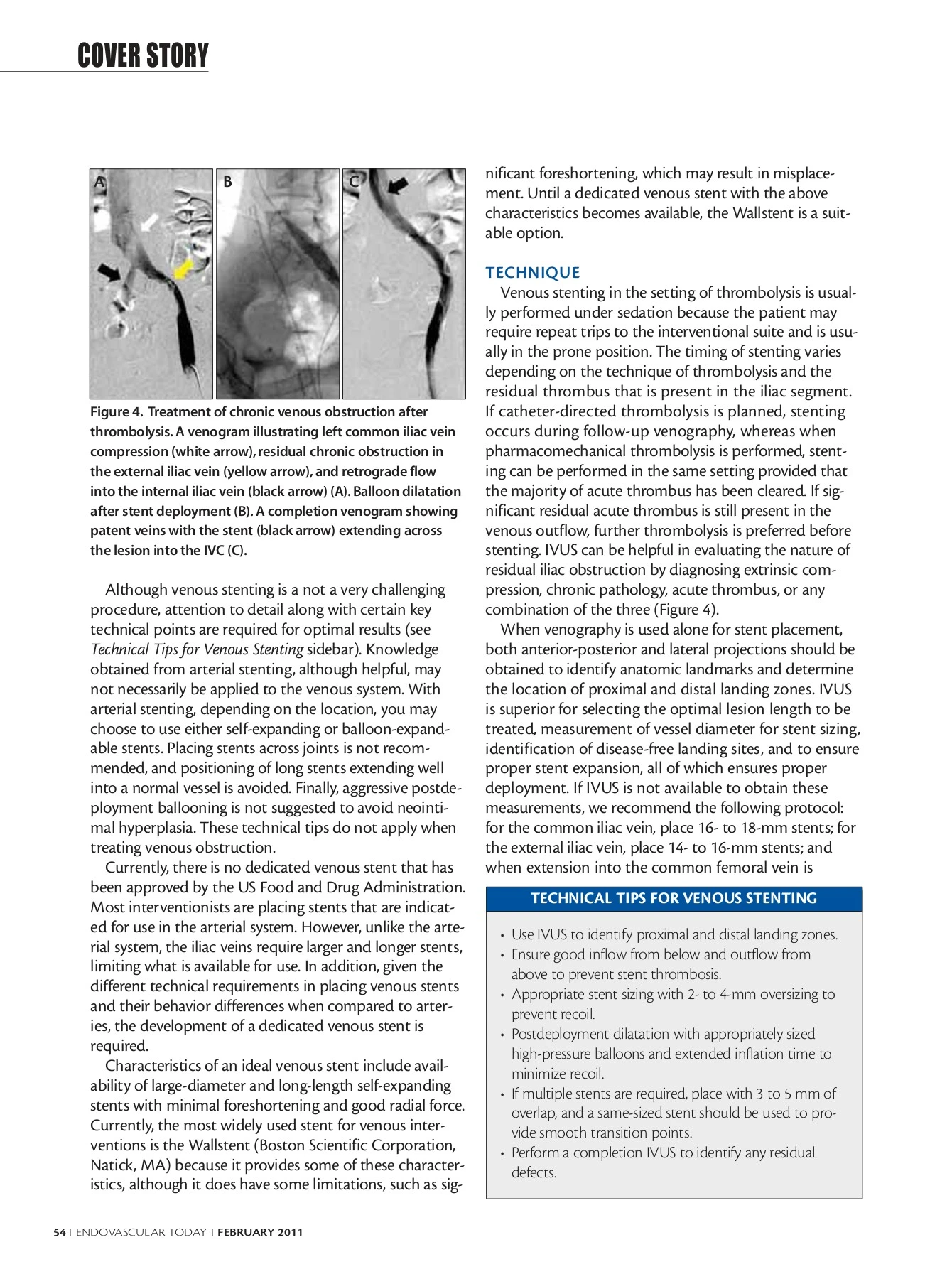 COVER STORY Venous Outflow Obstruction
