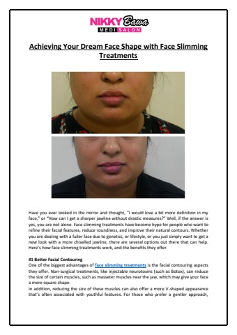 Dream Face Shape with Face Slimming Treatments